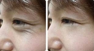 БОСВЕЛЛІЄВА ЕСЕНЦІЯ