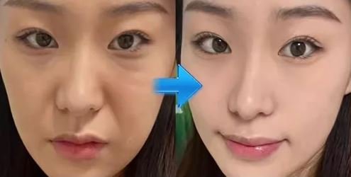 БОСВЕЛЛІЄВА ЕСЕНЦІЯ